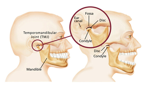 jaw-pain-treatment-perth-fortitude-chiropractic